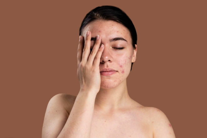 Як впливає на шкіру прострочена косметика