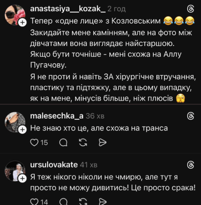 Саша Бо зараз - блогерка зробила пластичні операції - фото