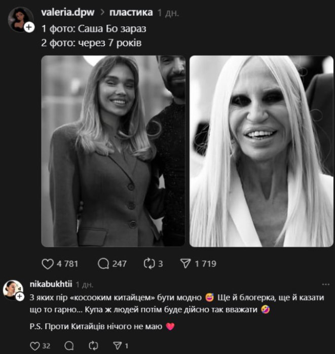 Саша Бо зараз - блогерка зробила пластичні операції - фото