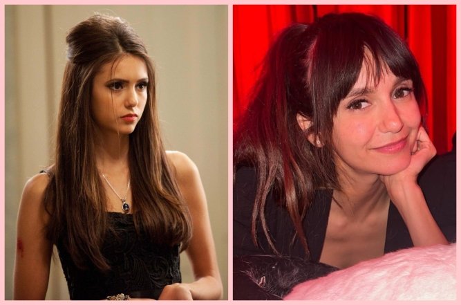 Ніна Добрев до та після пластики