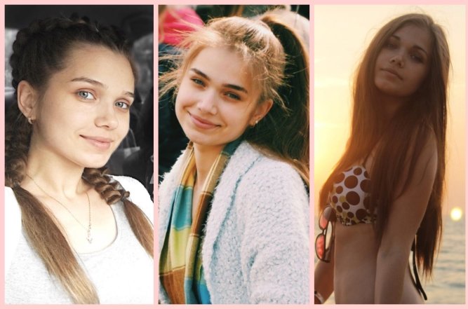 Саша Бо до операций, фото