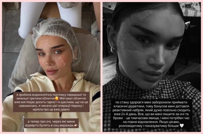 Саша Бо после операции, фото