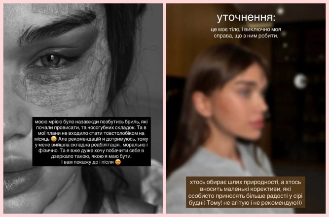 Саша Бо сделала подтяжку лица, фото