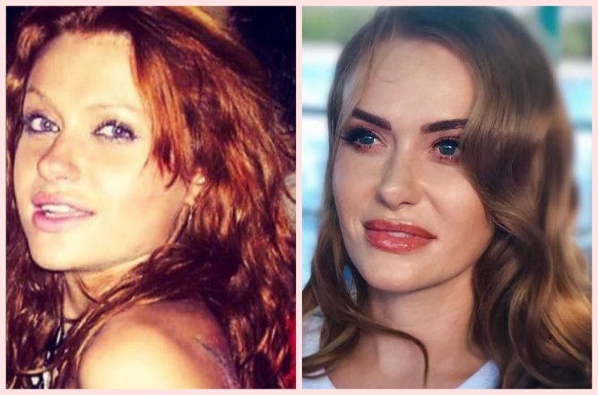 Слава Камінська до та після пластики, фото