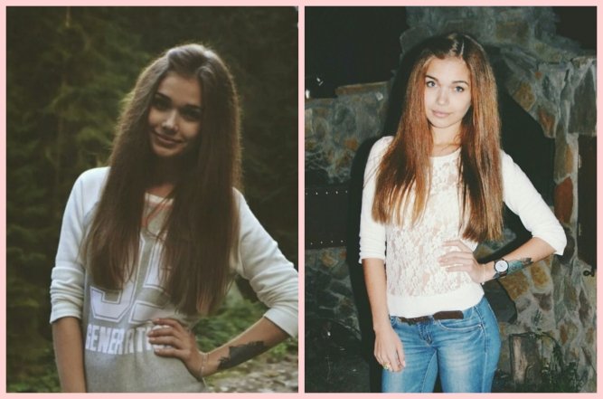 Саша Бо до пластики, фото