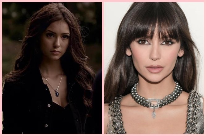 Ніна Добрев зробила пластику, фото