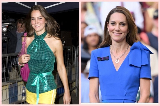 Кейт Міддлтон мамопластика, фото