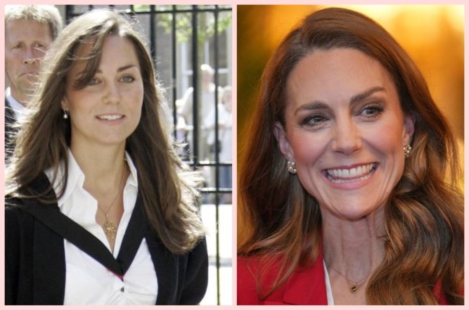 Кейт Міддлтон блефаропластика, фото