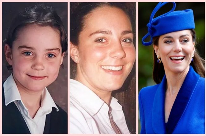 Кейт Міддлтон ніс, фото