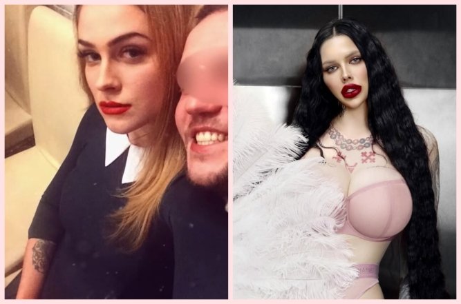 Марія Тиха до і після пластики