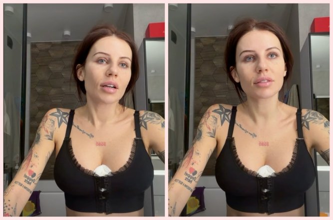 Анна Алхім зробила груди, фото