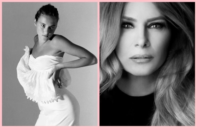 Мелания Трамп до и после пластики, фото