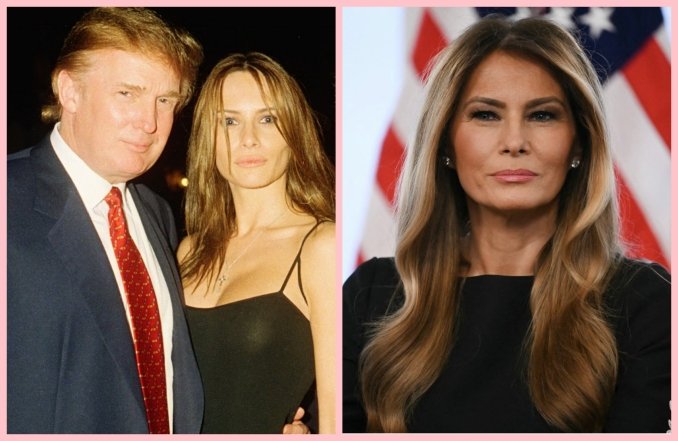 Мелания Трамп до и после пластики, фото