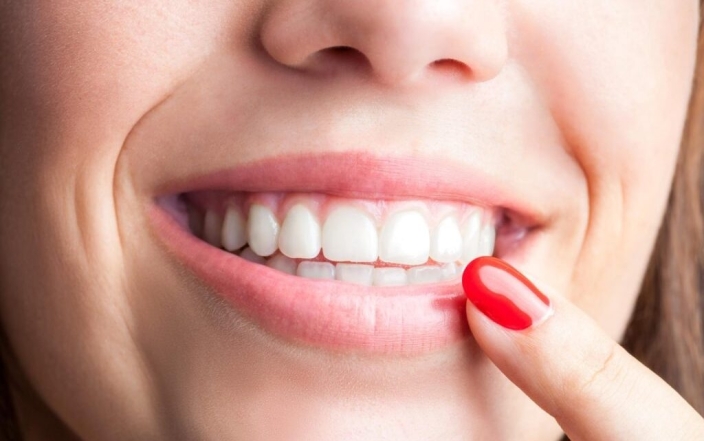 ТОП-5 причин, по которым ваши зубы меняют цвет - фото №1