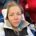 Олена Шоптенко потрапила в лікарню: танцівниця шокувала тим, що наразі може ходити лише на милицях (ФОТО)