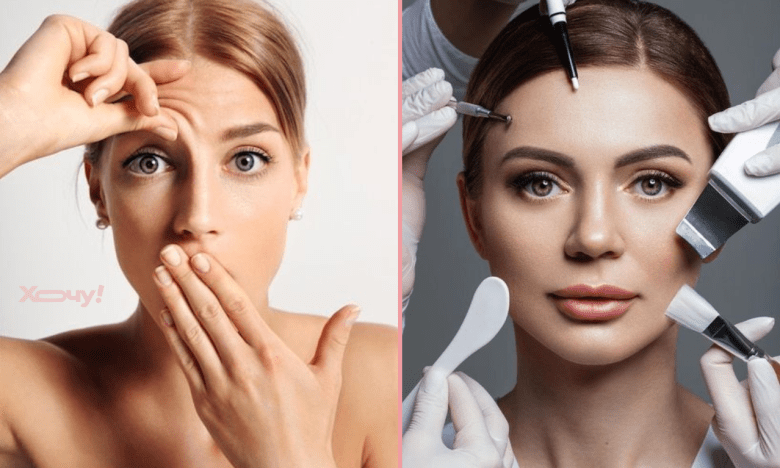 Как предупредить морщины на лбу