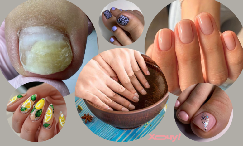 Как отбелить пожелтевшие ногти