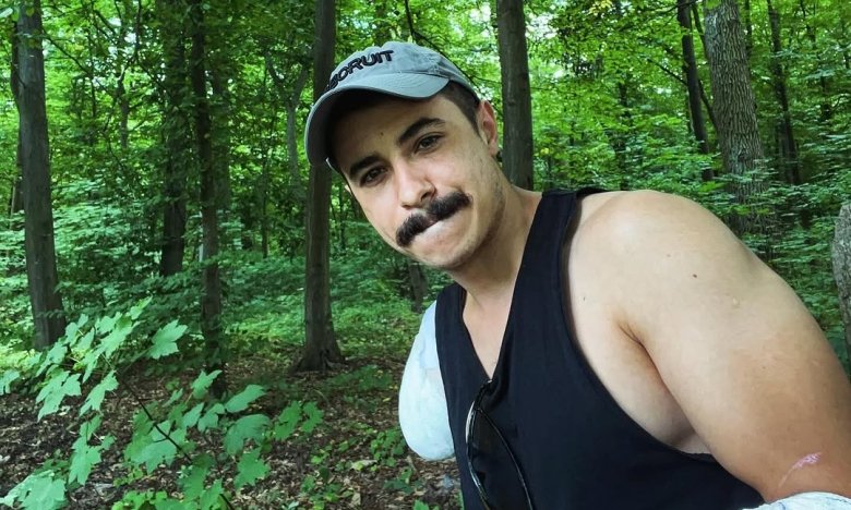 Ярослав Грубич втратив руку на війні - як це сталося