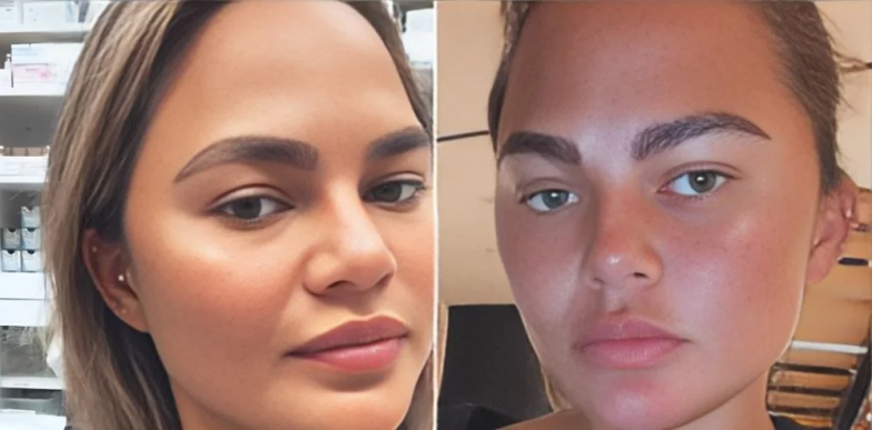 Крисси Тайген сделала пересадку бровей, фото