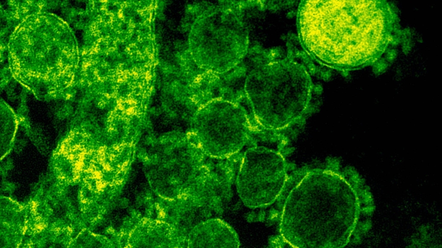 ВОЗ зафиксировали штамм коронавируса "Лямбда" более чем в 30 странах - фото №2