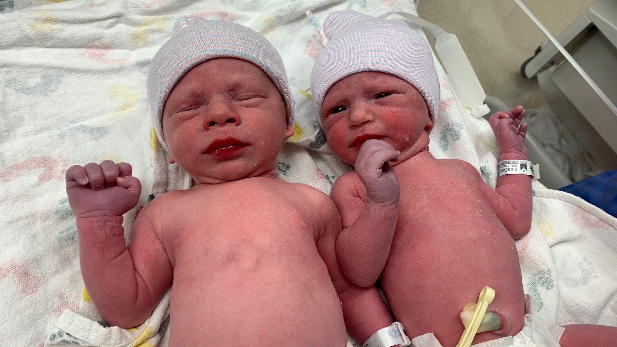 Такое впервые! В США родились близнецы из эмбрионов, замороженных 30 лет назад - фото №2