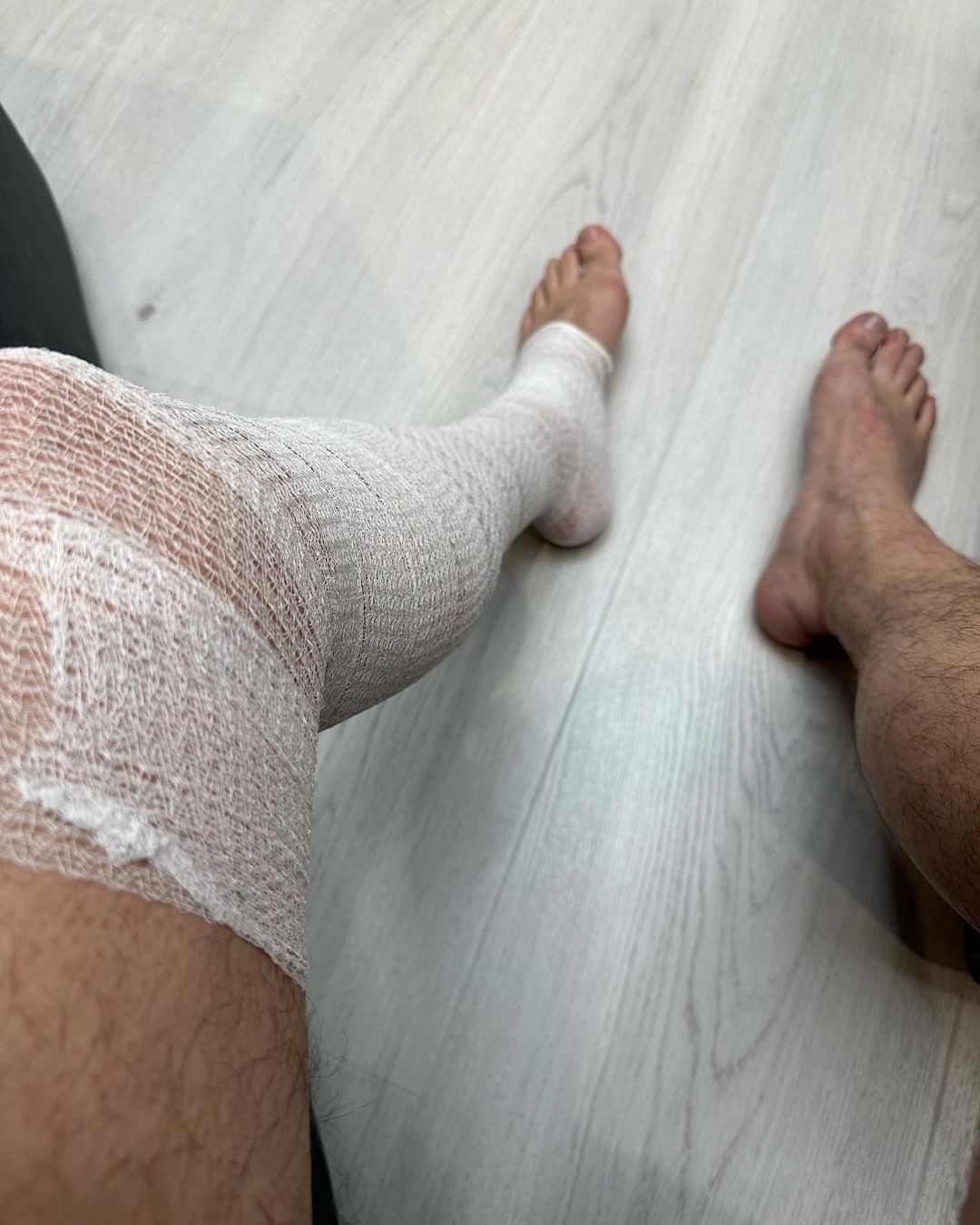 "Запрещают ходить": Виталий Ким серьезно травмировал ногу - фото №1