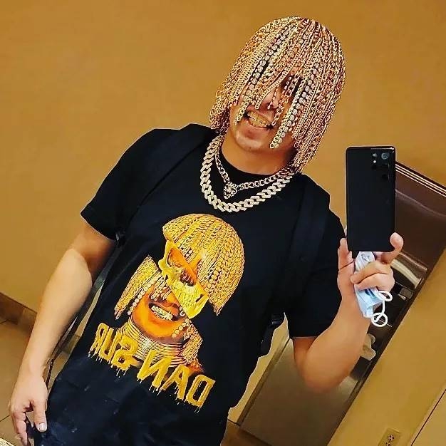 Мексиканский рэпер Dan Sur вместо волос вживил себе в голову десятки золотых цепей (ФОТО) - фото №1